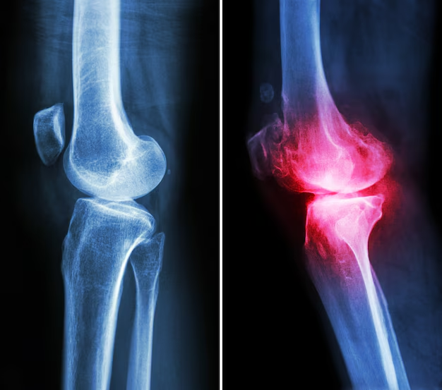 Arthritis & Joint Care